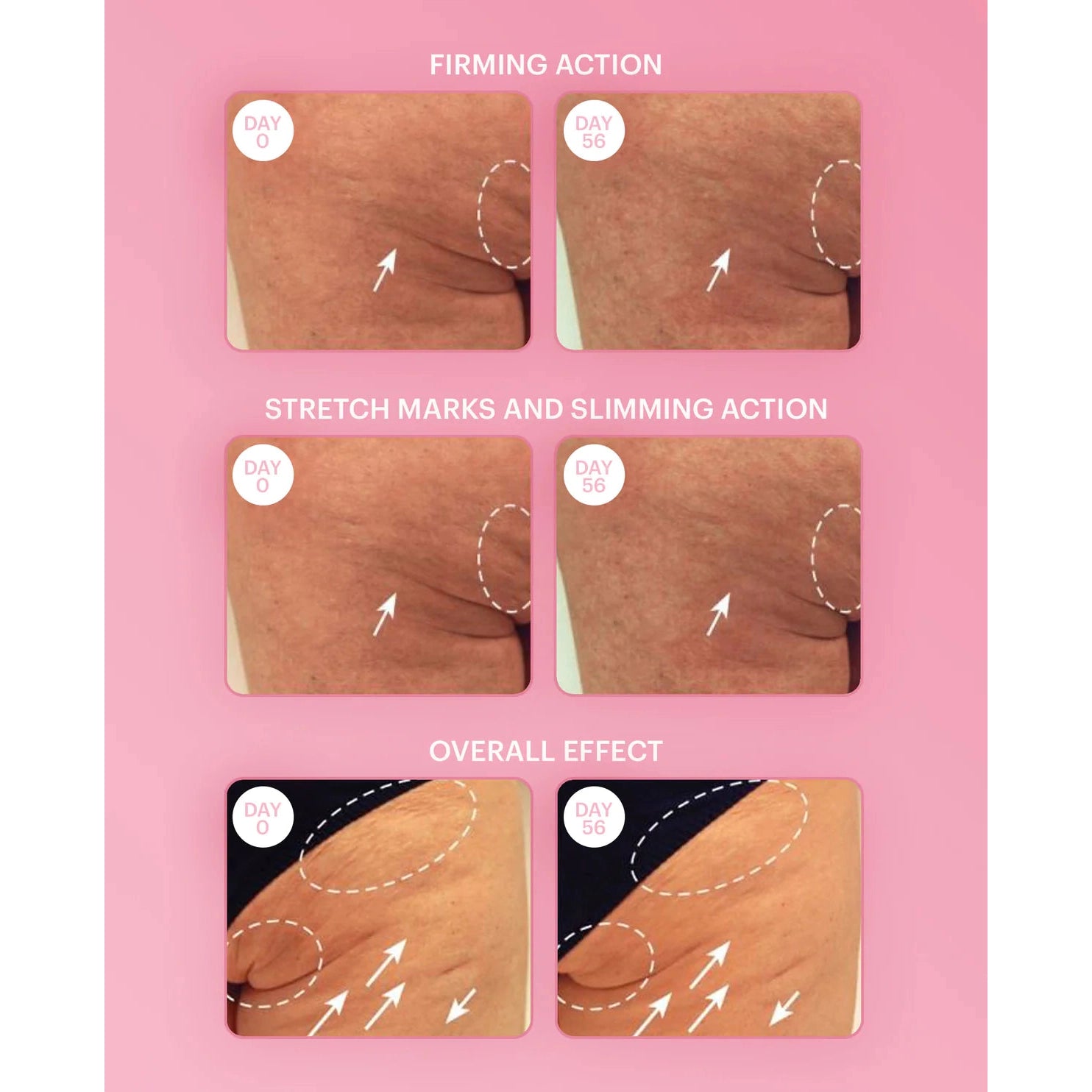 Firming Breast Lotion-Booby Tape-1000 Palms